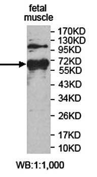 ZNF195 Rabbit Polyclonal Antibody