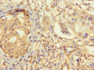 ZNF2 Antibody