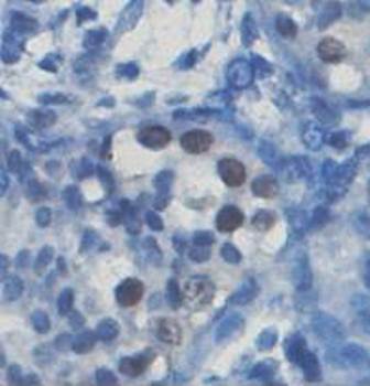 ZNF202 Rabbit Polyclonal Antibody