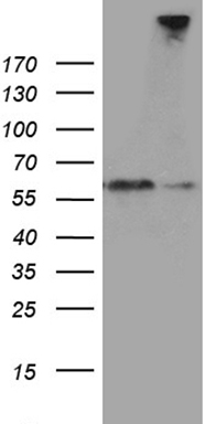 ZNF217 Antibody