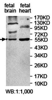 ZNF223 Rabbit Polyclonal Antibody