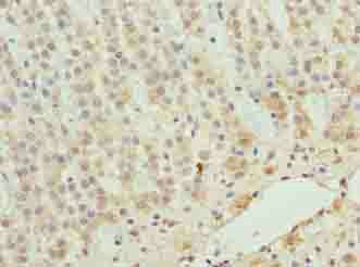 ZNF226 Antibody
