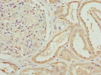 ZNF24 Antibody