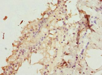 ZNF24 Antibody