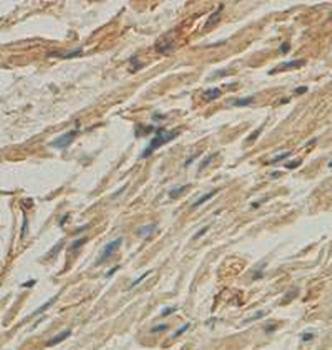 ZNF248 Rabbit Polyclonal Antibody