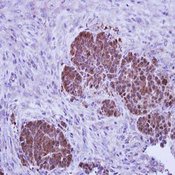 ZNF259 antibody