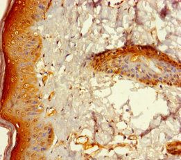 ZNF260 Antibody