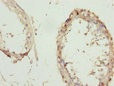 ZNF264 Antibody