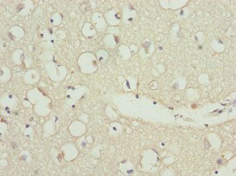 ZNF264 Antibody