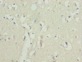 ZNF264 Antibody
