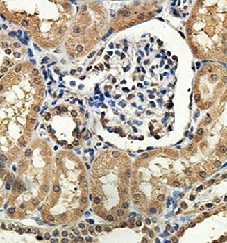 ZNF274 Rabbit Polyclonal Antibody