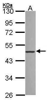 IRAK3 antibody
