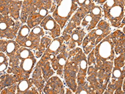 ZNF281 Antibody