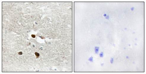 ZNF287 Antibody