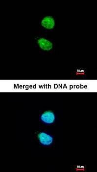 ZNF306 Rabbit Polyclonal Antibody