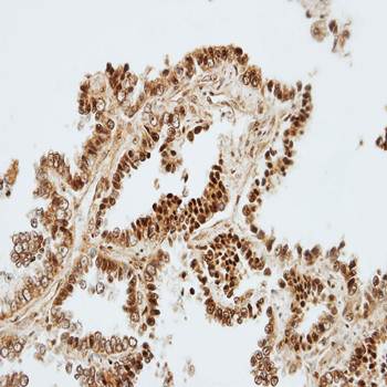 ZNF306 Rabbit Polyclonal Antibody