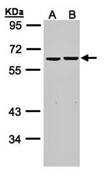 ZNF306 Rabbit Polyclonal Antibody