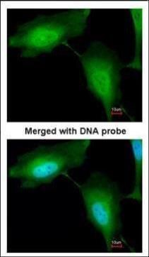 ZNF313 Rabbit Polyclonal Antibody