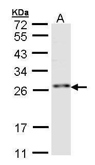 ZNF313 Rabbit Polyclonal Antibody