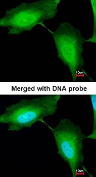 ZNF313 antibody
