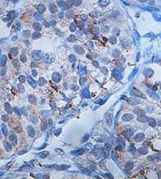 ZNF331 Rabbit Polyclonal Antibody