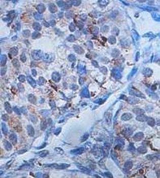 ZNF331 antibody