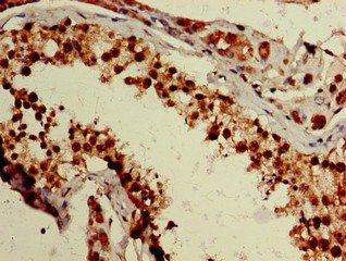 ZNF331 Antibody