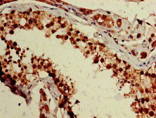 ZNF331 antibody