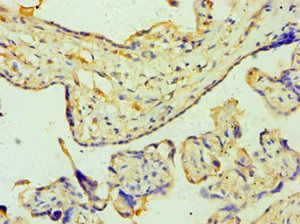 ZNF346 Antibody