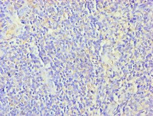 ZNF346 Antibody