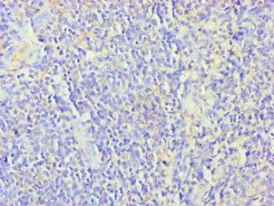 ZNF346 antibody