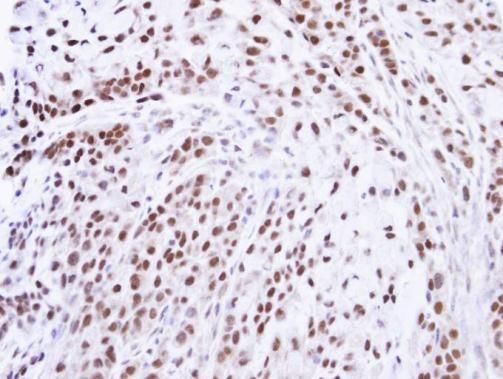 ZNF346 antibody [N1C3]