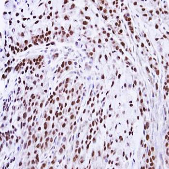 ZNF346 antibody