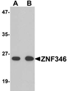 ZNF346 Rabbit Polyclonal Antibody