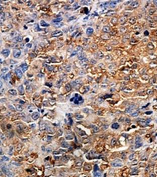 ZNF346 Rabbit Polyclonal Antibody