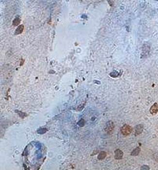 ZNF34 Rabbit Polyclonal Antibody