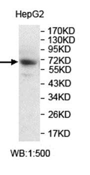 ZNF34 Rabbit Polyclonal Antibody