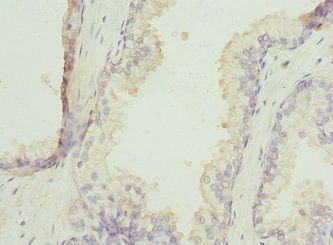 ZNF350 Antibody