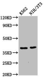 ZNF367 antibody