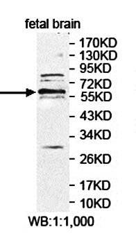 ZNF394 Rabbit Polyclonal Antibody