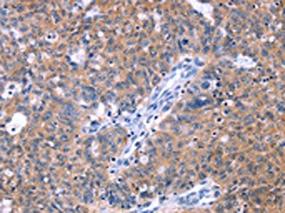 ZNF395 Antibody