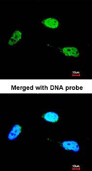 ZNF398 antibody