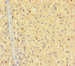 ZNF404 Antibody