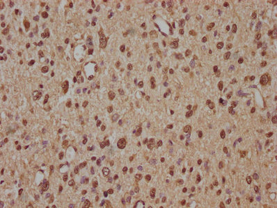 ZNF423 antibody