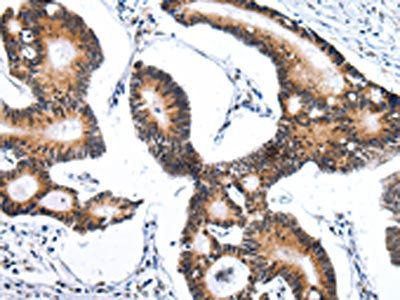 ZNF473 Antibody