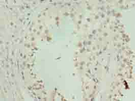 ZNF490 Antibody