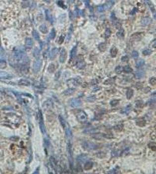 ZNF490 Rabbit Polyclonal Antibody