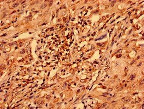 ZNF529 Antibody