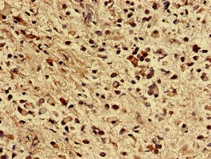 ZNF529 Antibody