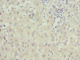 ZNF544 Antibody